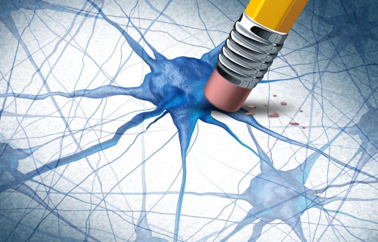 P rdida neurona Nepsa Rehabilitaci n Neurol gica p-rdida-neurona-nepsa-rehabilitaci-n-neurol-gica